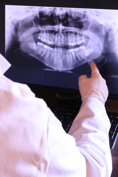 Best Emergency Dental Care for Sports Injuries in Crothersville, IN