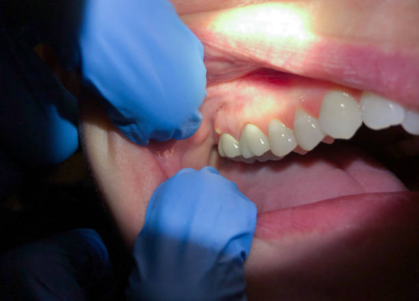 Best Emergency Orthodontic Repairs in Crothersville, IN