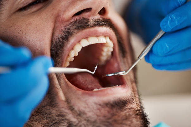 Best Emergency Denture Repair in Crothersville, IN
