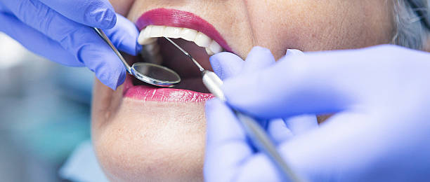 Best Knocked-Out Tooth (Avulsed Tooth) Treatment in Crothersville, IN